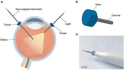 Additive Manufacturing of a Miniature Functional Trocar for Eye Surgery